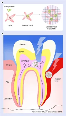  Rhabdophane: 骨の再生と歯の修復に革命をもたらす可能性を秘めたナノ材料！